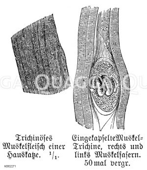 Trichinöses Muskelfleisch einer Hauskatze (links) und zwischen Muskelfasern eingekapselte Muskeltrichine (rechts) [Digital]