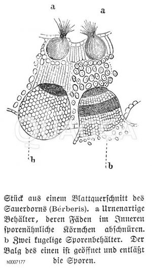 Sauerdornwarzenbrand: Blattquerschnitt [Digital]