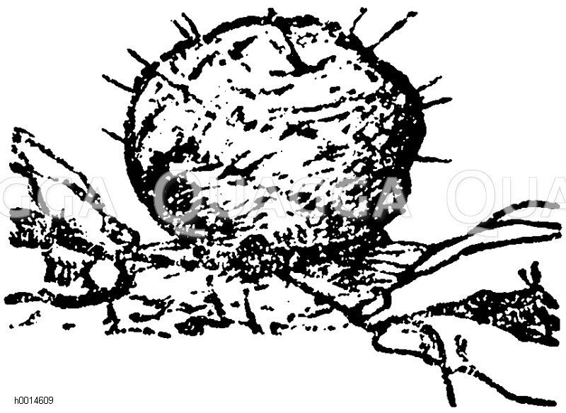 Abbinden von Gewächsen und Geschwülsten, Abbinden einer Warze [Digital]