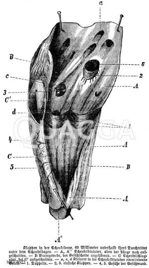 Klappen in der Schenkelvene [Digital]