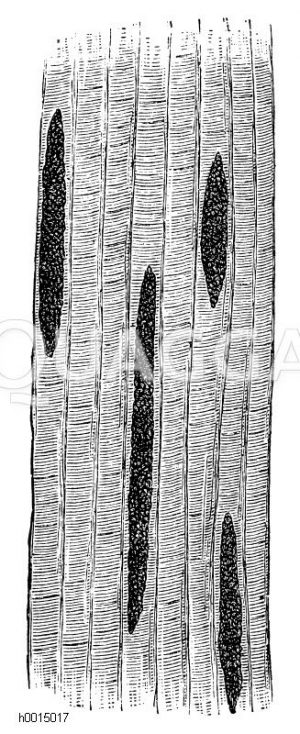 Miescher'sche Schläuche im Schweinefleisch [Digital]