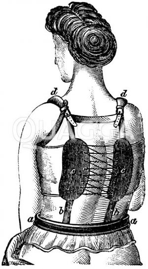 Verkrümmung der Wirbelsäule [Digital]