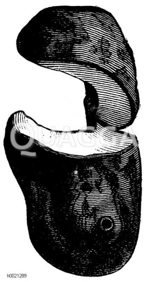 Nierenförmiger Lederschwamm, aufgeschnitten [Digital]