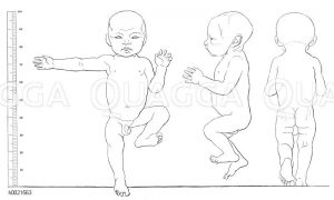 Proportionen eines neugeborenen Kindes (nach Schwadow) Zeichnung/Illustration
