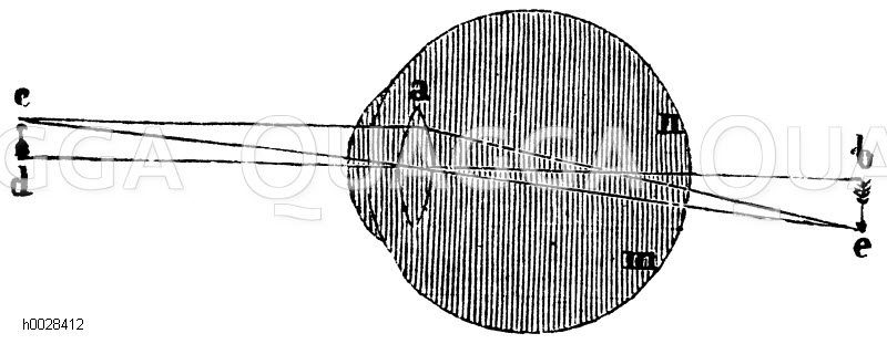 Weitsichtiges Auge, Weitsichtigkeit [Digital]