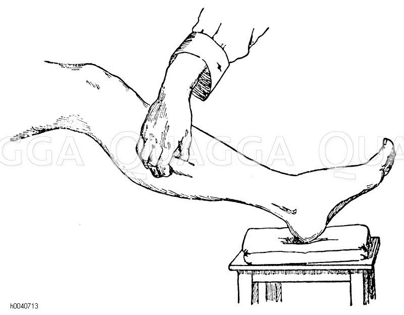 Massage: Kneten eines Muskels des Unterschenkels [Digital]