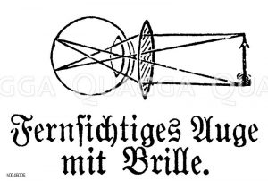 Fernsichtiges Auge mit Brille [Digital]