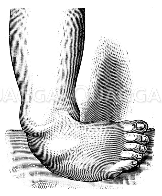 Klumpfuß Quagga Illustrations