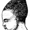 Kopfform bei Hinterhauptlage während der Geburt Zeichnung/Illustration