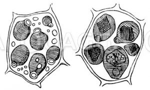 Aleuronkörner in der Zelle des Endosperms von Ricinus communis