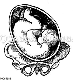 Lage eines Kindes in der Gebärmutter: Schulterlage