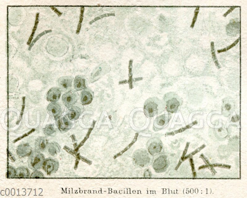 Milzbrandbakterien im Blut