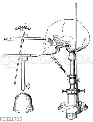 Winkelmessung am Schädel eines Menschen