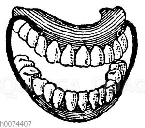Künstliches Gebiss