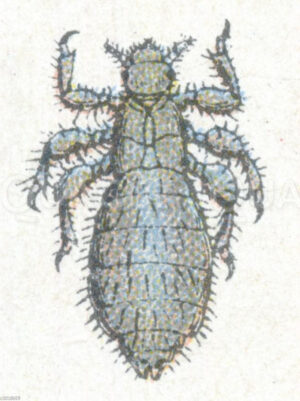 Kopflaus